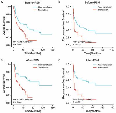 Effect of Perioperative Blood Transfusion on the Postoperative Prognosis of Ruptured Hepatocellular Carcinoma Patients With Different BCLC Stages: A Propensity Score Matching Analysis